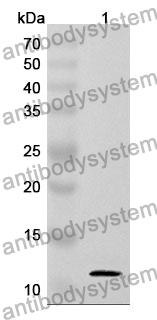 Anti-Human SFI1 Polyclonal Antibody