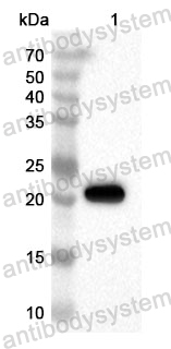 Anti-Human SATB2 Polyclonal Antibody