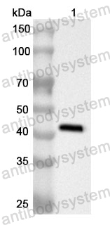 Anti-Human GTPBP4 Polyclonal Antibody