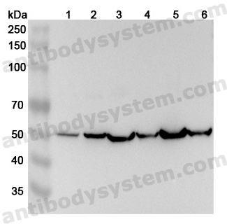 Anti-Human ACTL7A Polyclonal Antibody