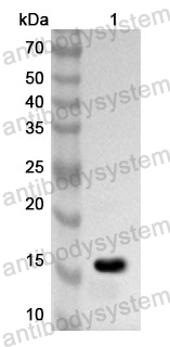 Anti-Human NHEJ1 Polyclonal Antibody