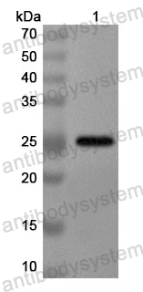 Anti-Human TRIM15 Polyclonal Antibody