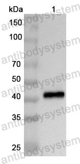 Anti-Human USP21 Polyclonal Antibody