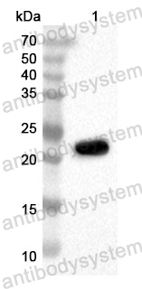 Anti-Human ADI1 Polyclonal Antibody