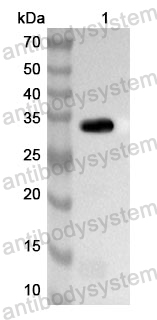 Anti-Human TAOK1 Polyclonal Antibody