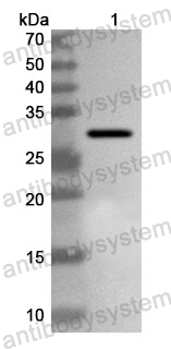 Anti-Human VANGL2 Polyclonal Antibody