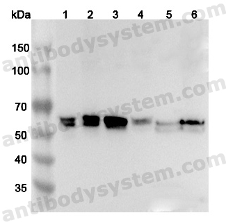 Anti-Human NAP1L4 Polyclonal Antibody