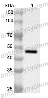 Anti-Human ACAD9 Polyclonal Antibody