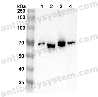 Anti-Human ISYNA1 Polyclonal Antibody