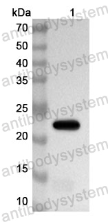 Anti-Human MYOT Polyclonal Antibody