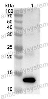 Anti-Human UTP14A Polyclonal Antibody