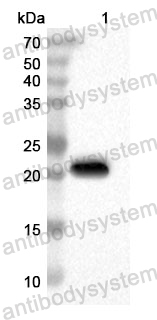 Anti-Human PPP3R2 Polyclonal Antibody