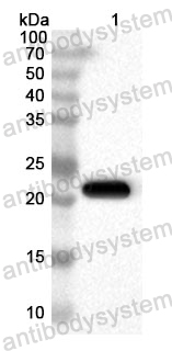 Anti-Human RBM15B Polyclonal Antibody