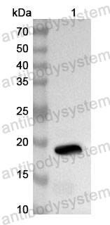 Anti-Human CIAPIN1 Polyclonal Antibody