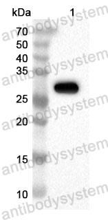 Anti-Human DTX4 Polyclonal Antibody