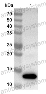 Anti-Human EHBP1 Polyclonal Antibody