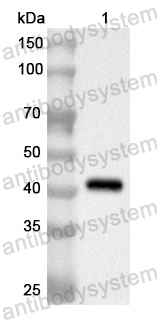 Anti-Human EHD2 Polyclonal Antibody