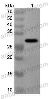 Anti-Human EIF2AK1 Polyclonal Antibody