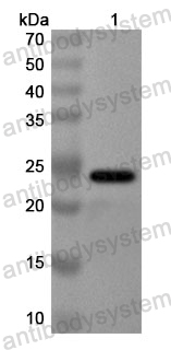 Anti-Human GSDMC Polyclonal Antibody