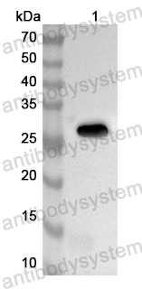 Anti-Human NUP93 Polyclonal Antibody