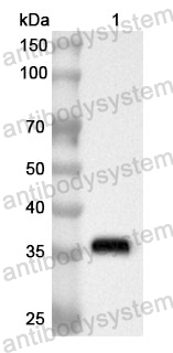 Anti-Human POLDIP2 Polyclonal Antibody