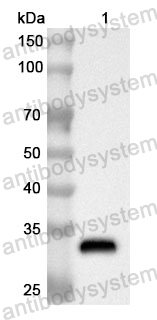 Anti-Human RABGEF1 Polyclonal Antibody