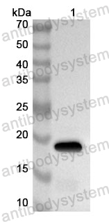 Anti-Human RBCK1 Polyclonal Antibody