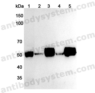 Anti-Human RCOR1 Polyclonal Antibody