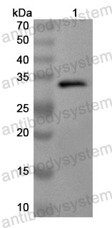 Anti-Human RLIM Polyclonal Antibody