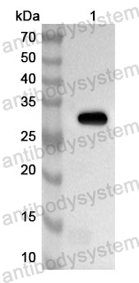 Anti-Human SMARCC1 Polyclonal Antibody