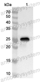 Anti-Human SNX25 Polyclonal Antibody