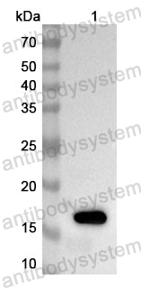 Anti-Human SYCE1 Polyclonal Antibody