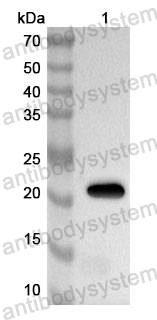 Anti-Human TFG Polyclonal Antibody