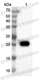 Anti-Human TGIF2 Polyclonal Antibody