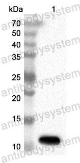 Anti-Human TRPC4AP Polyclonal Antibody