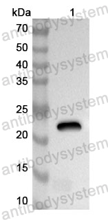 Anti-Human NSFL1C Polyclonal Antibody