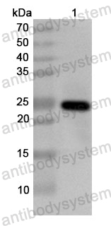 Anti-Human RNF6 Polyclonal Antibody