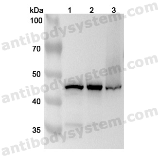 Anti-Human HSDL2 Polyclonal Antibody