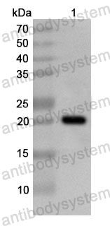 Anti-Human HSPB8 Polyclonal Antibody