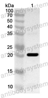 Anti-Human MAD1L1 Polyclonal Antibody