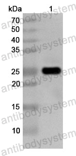 Anti-Human MAGEC2 Polyclonal Antibody