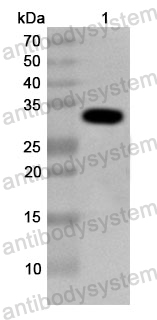 Anti-Human MCM8 Polyclonal Antibody