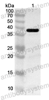 Anti-Human MECR Polyclonal Antibody