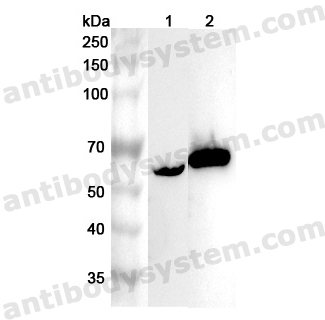 Anti-Human RIOX2 Polyclonal Antibody