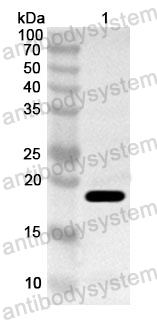 Anti-Human MYOZ1 Polyclonal Antibody