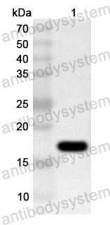 Anti-Human PDRG1 Polyclonal Antibody