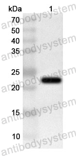 Anti-Human SLCO2A1 Polyclonal Antibody