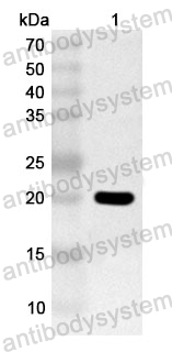 Anti-Human PMFBP1 Polyclonal Antibody