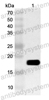 Anti-Human ZKSCAN3 Polyclonal Antibody