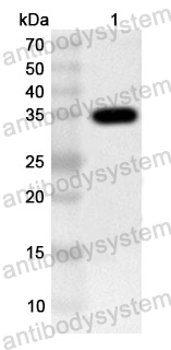 Anti-Human ZMYND8 Polyclonal Antibody